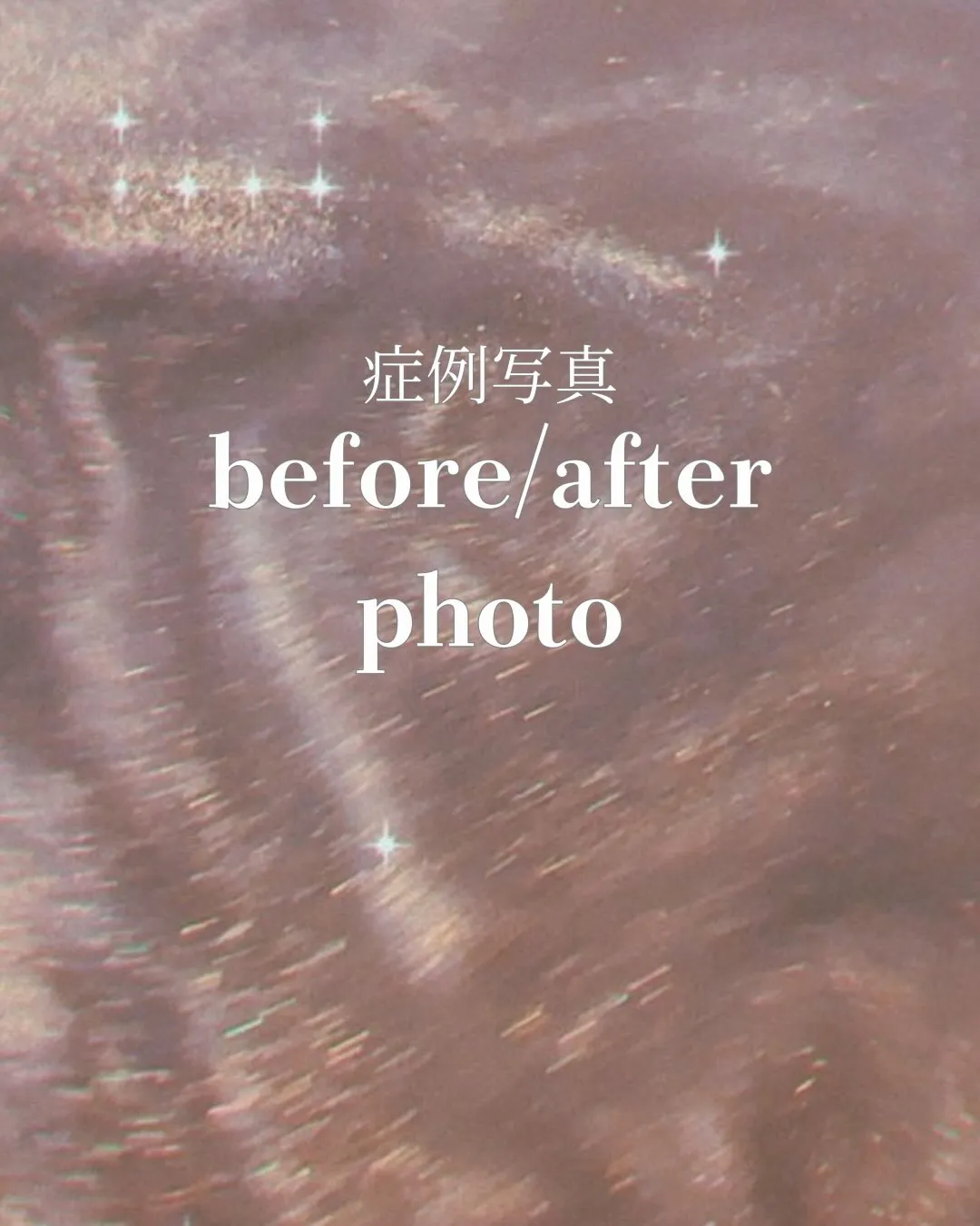 Liréa atelier Harajukuの一部症例のご紹...