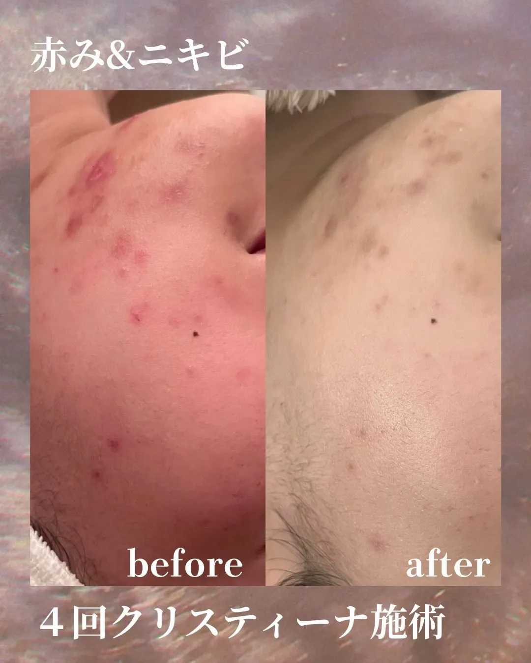 Liréa atelier Harajukuの一部症例のご紹...