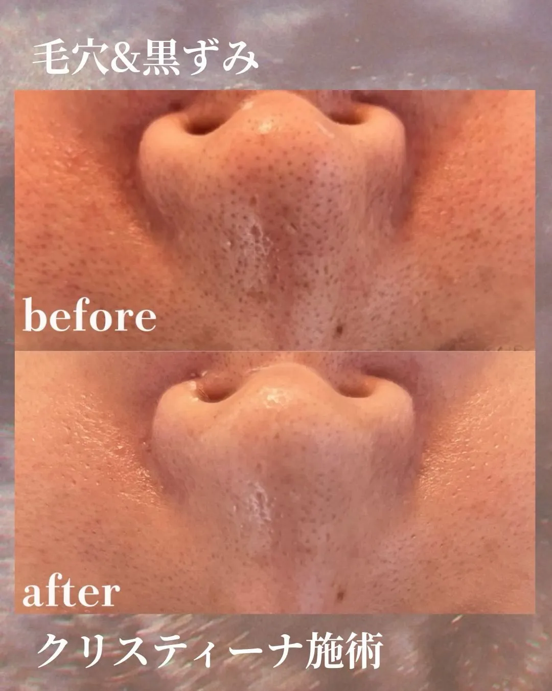 Liréa atelier Harajukuの一部症例のご紹...