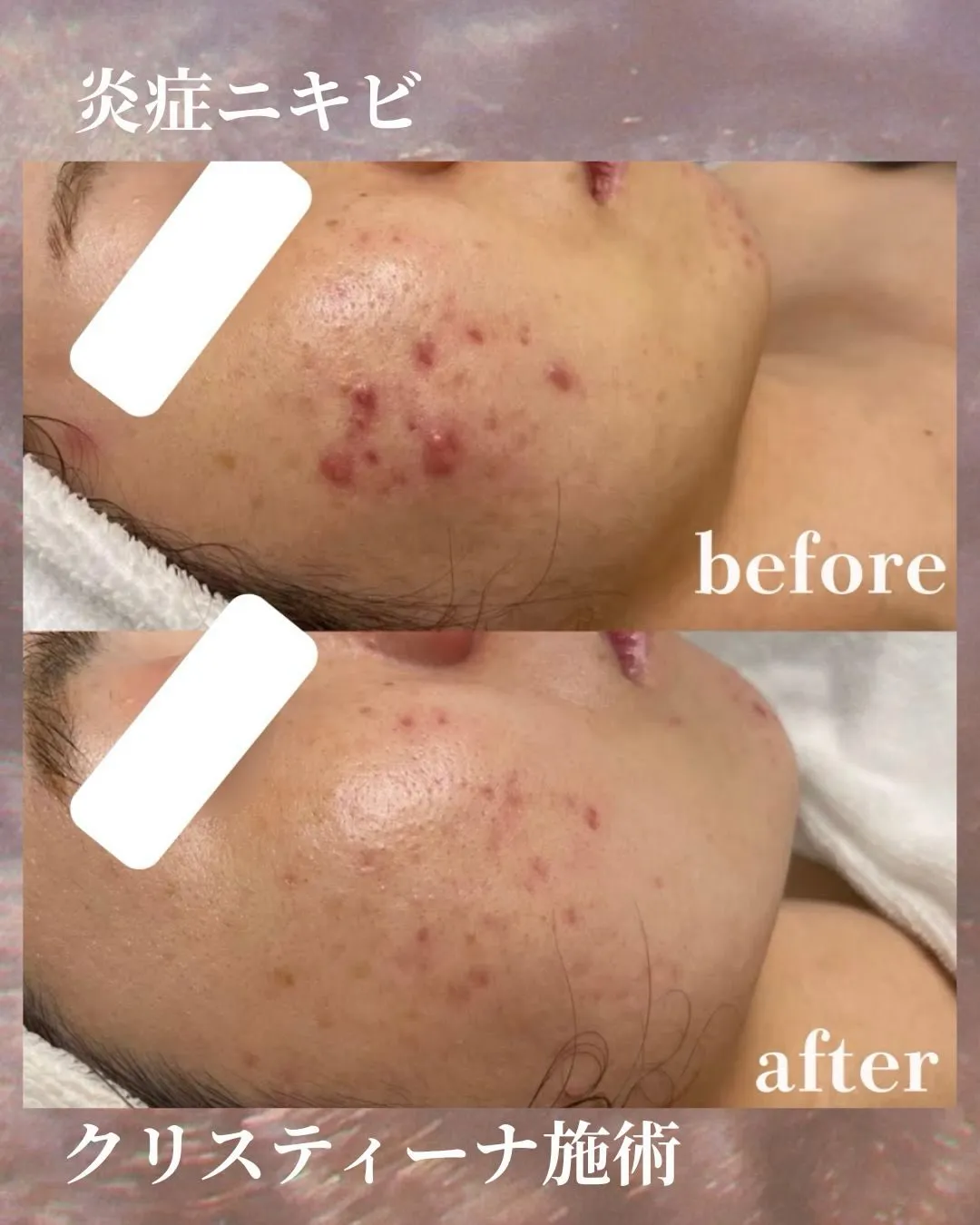 Liréa atelier Harajukuの一部症例のご紹...