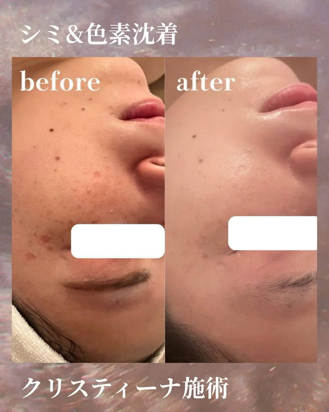 Liréa atelier Harajukuの一部症例のご紹...